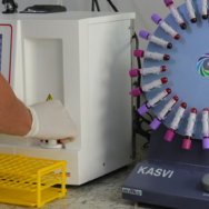 Exames laboratoriais veterinários na clínica de grande animais